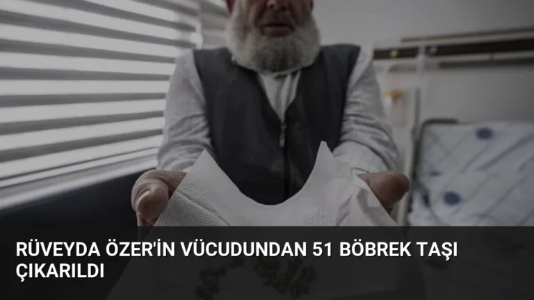 Rüveyda Özer’in Vücudundan 51 Böbrek Taşı Çıkarıldı